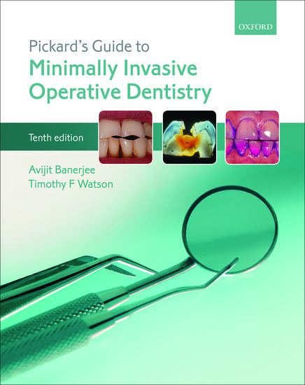 Cover for Pickard's Guide to Minimally Invasive Operative Dentistry book