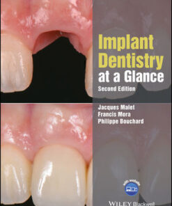 Cover for Implant Dentistry at a Glance, 2nd Edition book