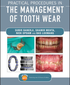 Cover for Practical Procedures in the Management of Tooth Wear book