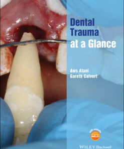 Cover for Dental Trauma at a Glance book