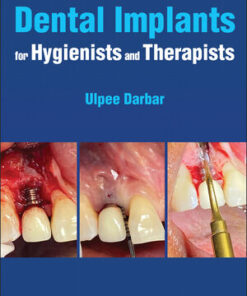 Cover for Dental Implants for Hygienists and Therapists book